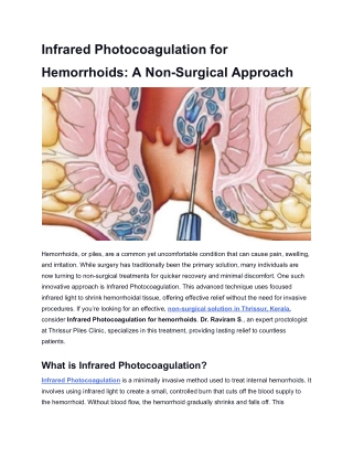 infrared photocoagulation for
