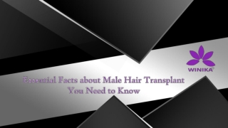 Essential Facts about Male Hair Transplant You Need to Know