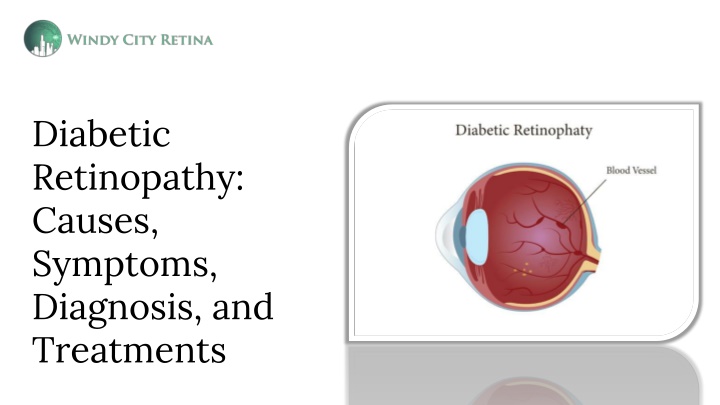 diabetic retinopathy causes symptoms diagnosis