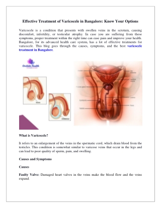 Effective Treatment of Varicocele in Bangalore Know Your Options