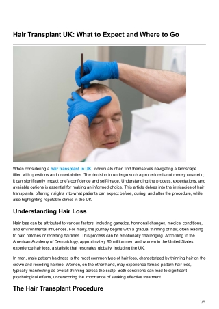 Hair Transplant UK What to Expect and Where to Go