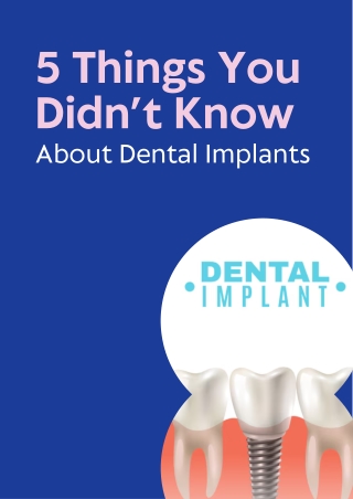 5 Things You Didn’t Know About Dental Implants