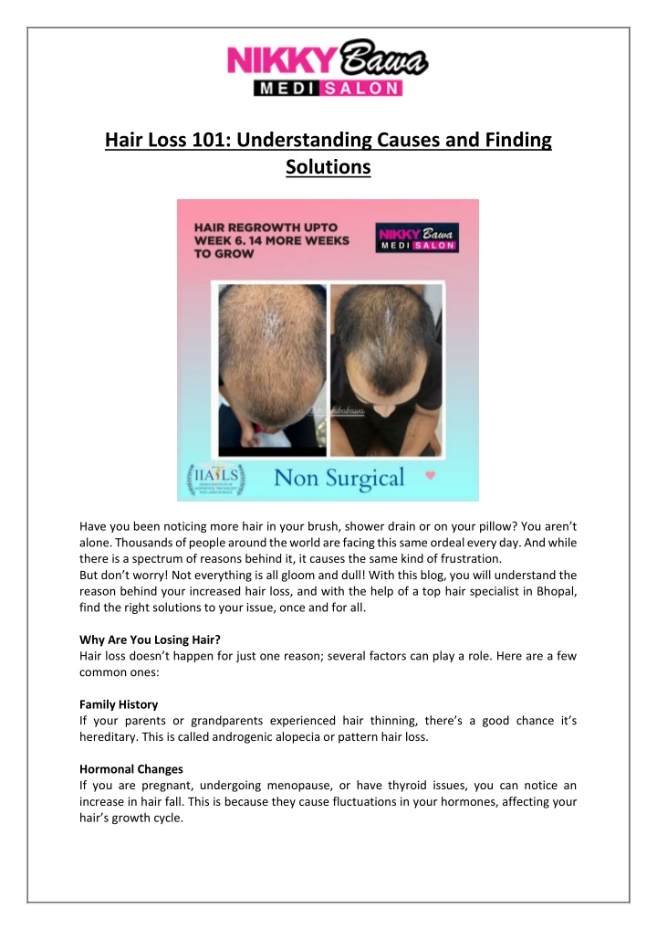 hair loss 101 understanding causes and finding