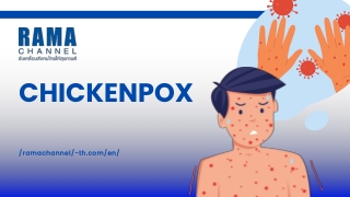 chickenpox