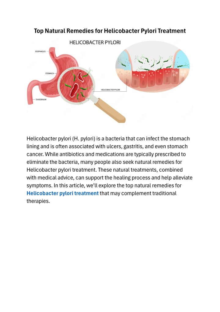 top natural remedies for helicobacter pylori