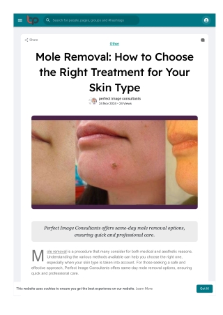 Mole Removal: How to Choose the Right Treatment for Your Skin Type