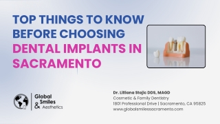 Top Things to Know Before Choosing Dental Implants in Sacramento