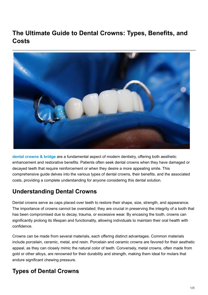 PPT The Ultimate Guide To Dental Crowns Types Benefits And Costs PowerPoint Presentation ID