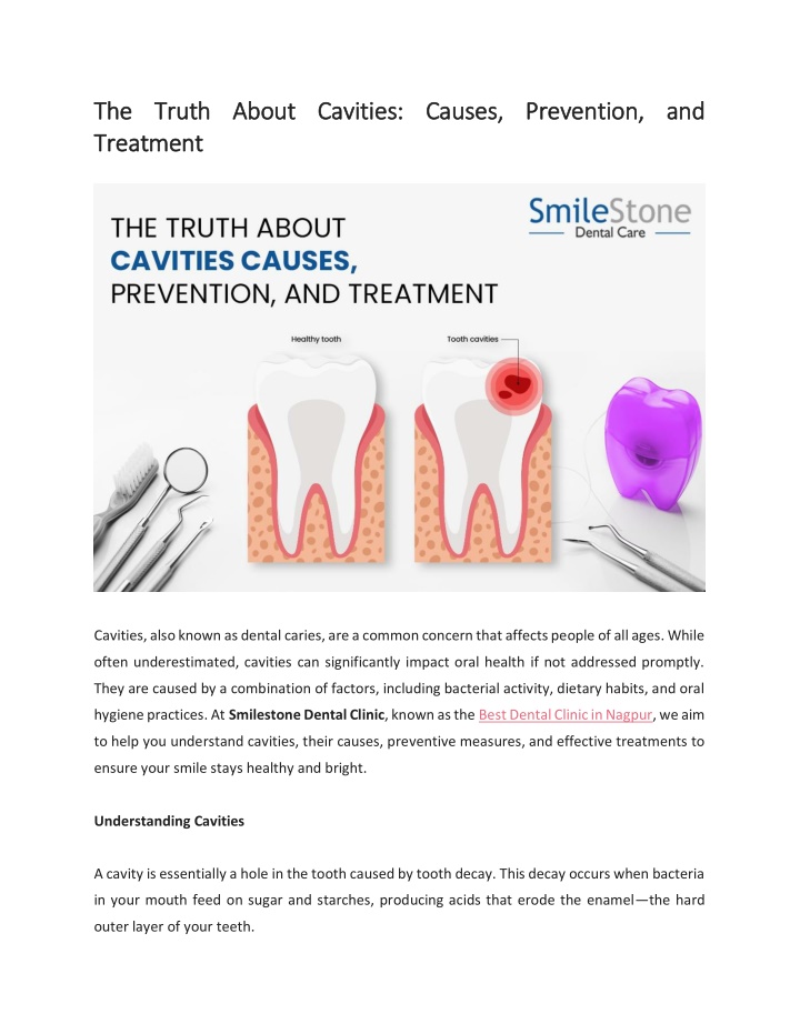 the truth about cavities causes prevention