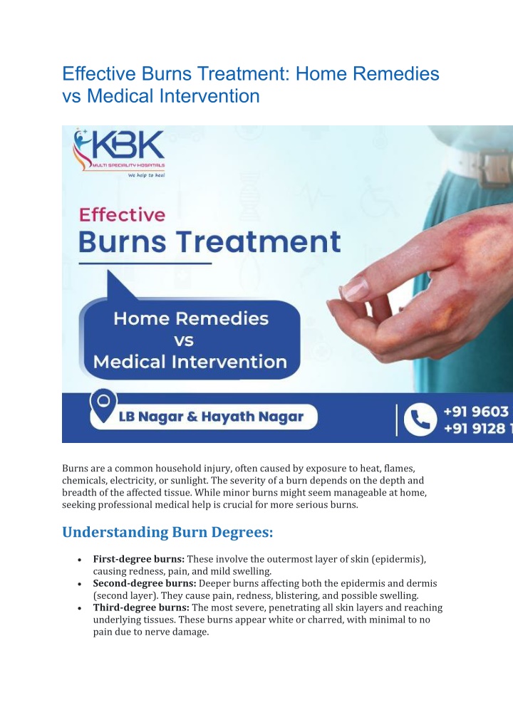 effective burns treatment home remedies