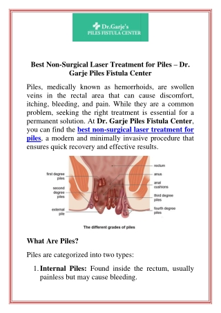 Best Non Surgical Laser Treatment For Piles