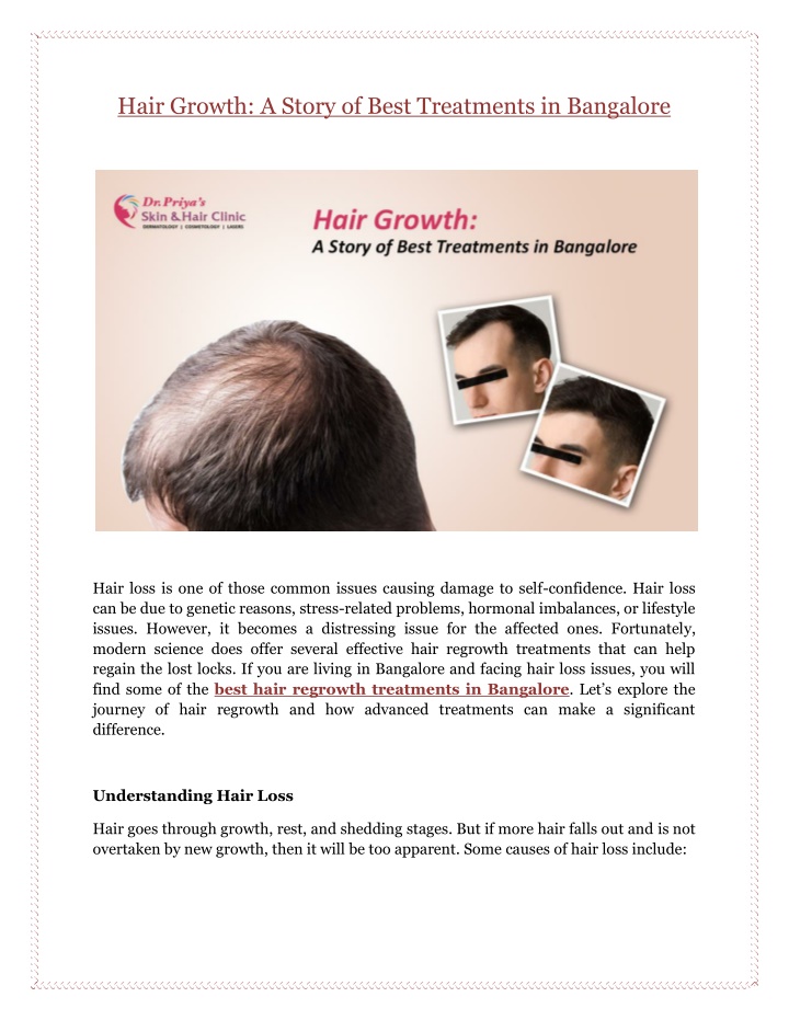 hair growth a story of best treatments