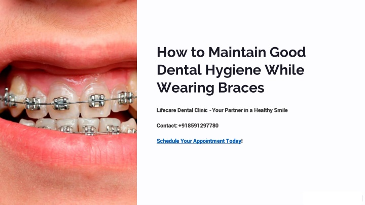 how to maintain good dental hygiene while wearing