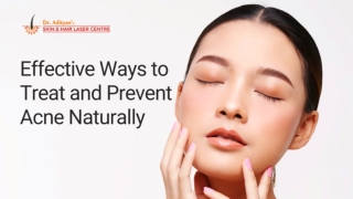 Natural Acne Treatment: Simple Tips for Clear Skin