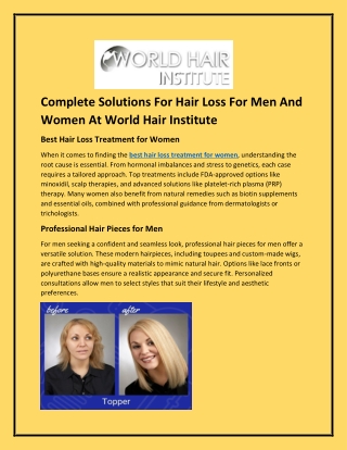 Complete Solutions For Hair Loss For Men And Women At World Hair Institute