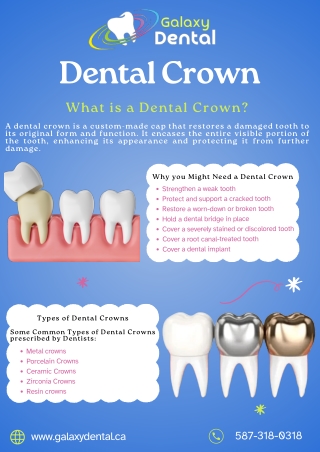 Tooth Crowns and Bridges | Dental Crowns in Calgary - Galaxy Dental