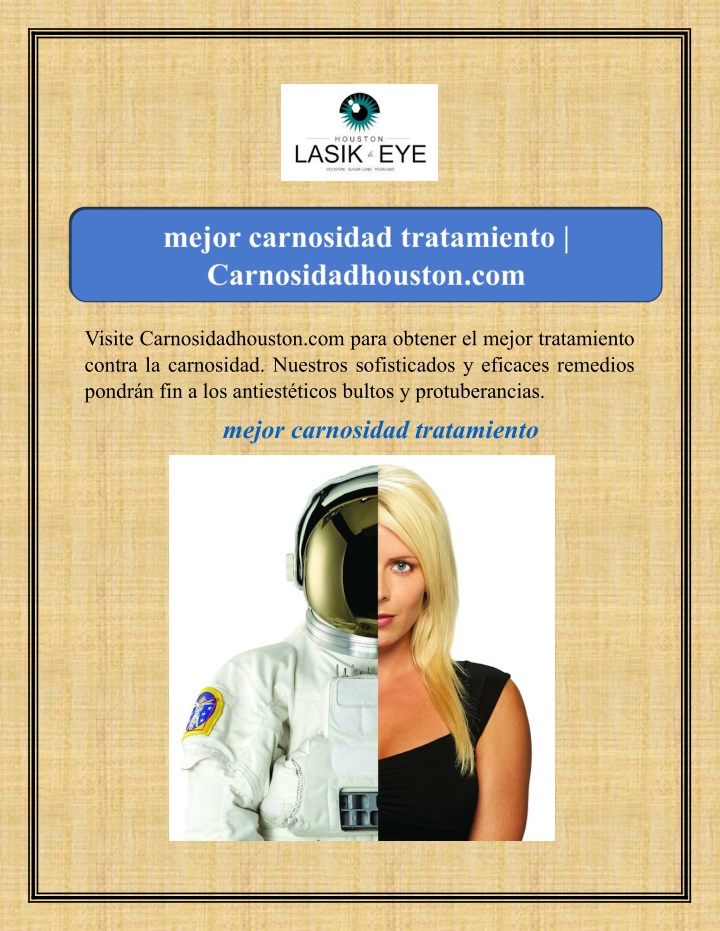 visite carnosidadhouston com para obtener