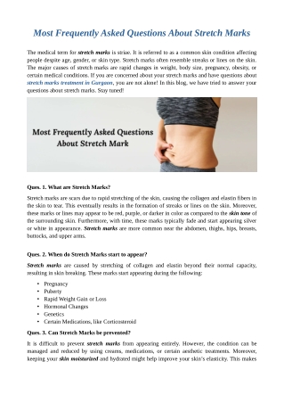 Most Frequently Asked Questions About Stretch Marks