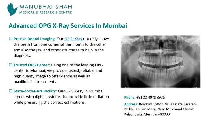 advanced opg x ray services in mumbai