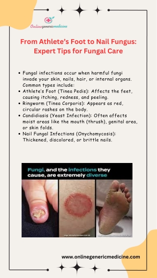 From Athlete’s Foot to Nail Fungus Expert Tips for Fungal Care