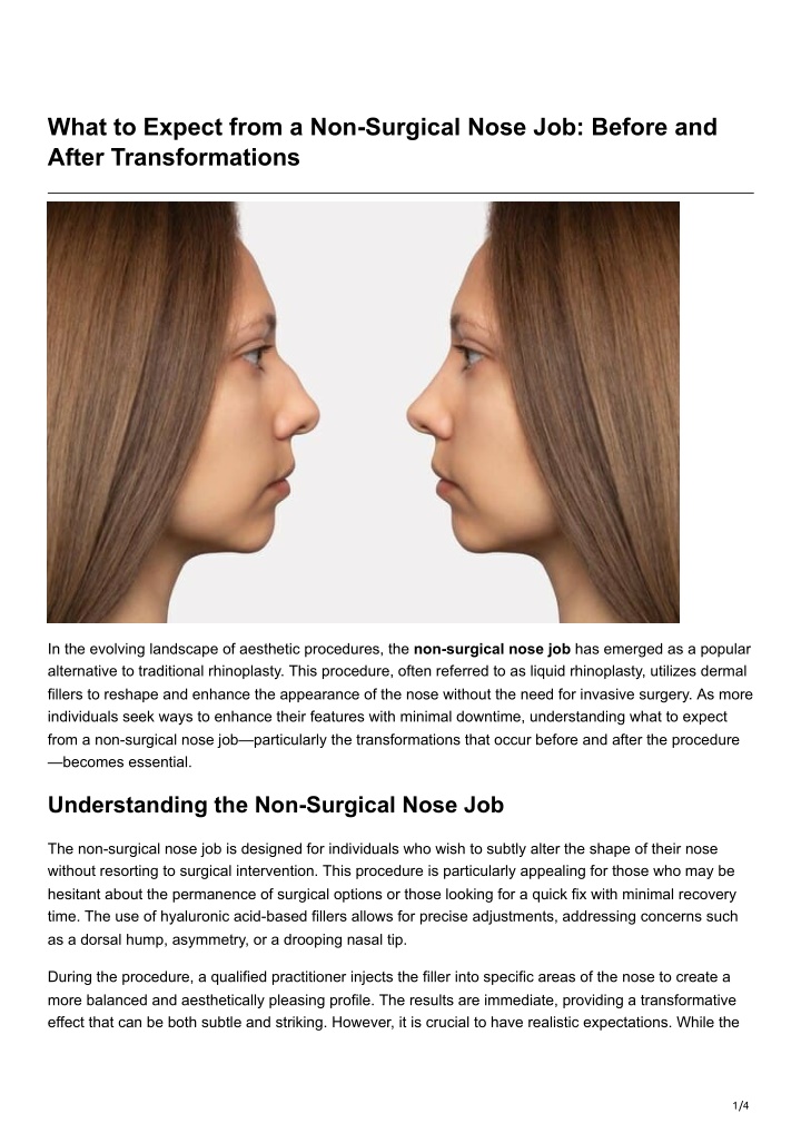 what to expect from a non surgical nose