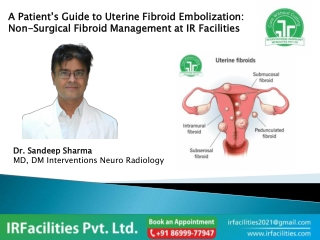 uterine fibroids Embolization Specialist PDF