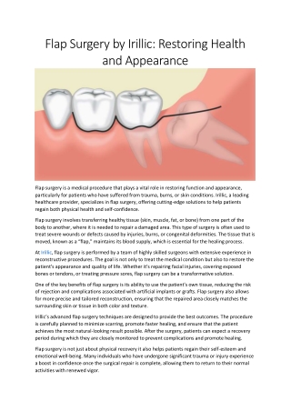 flap surgery by irillic restoring health