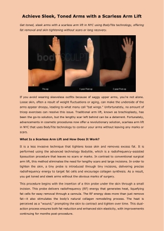 Achieve Sleek, Toned Arms with a Scarless Arm Lift