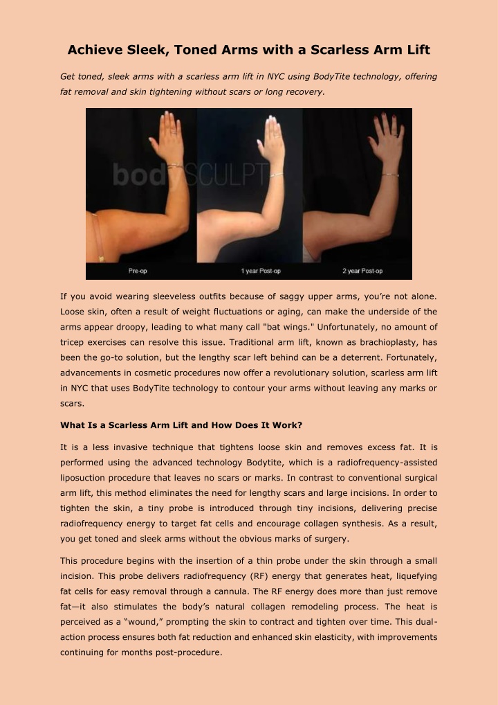 achieve sleek toned arms with a scarless arm lift