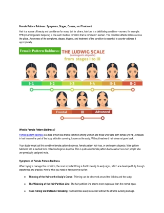 Female Pattern Baldness- Symptoms, Stages, Causes, and Treatment