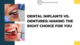 Dental Implants vs. Dentures Making the Right Choice for You