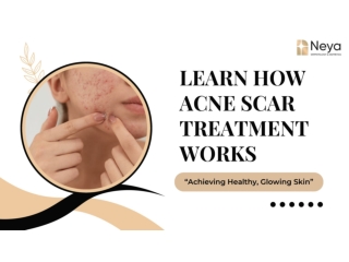 Learn How  Acne Scars Treatments in Hyderabad Works | Dr. Ravali