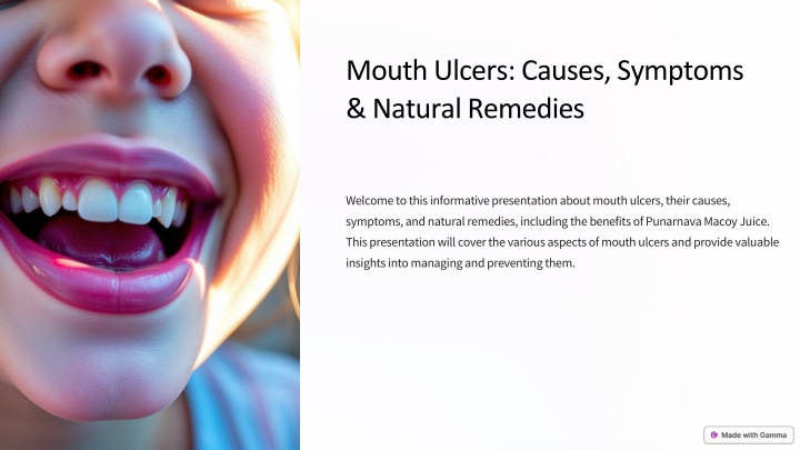 mouth ulcers causes symptoms natural remedies