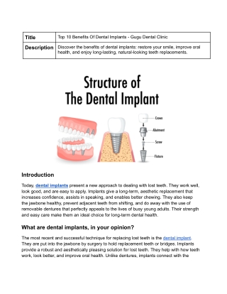 Gugu Dental Clinic - The Structure of Dental implants Blog