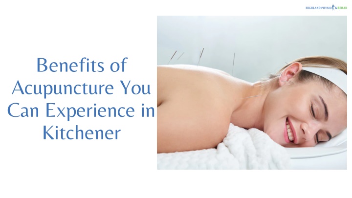 benefits of acupuncture you can experience