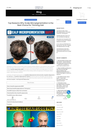 Top Reasons Why Scalp Micropigmentation is the Best Choice for Thinning-Hair