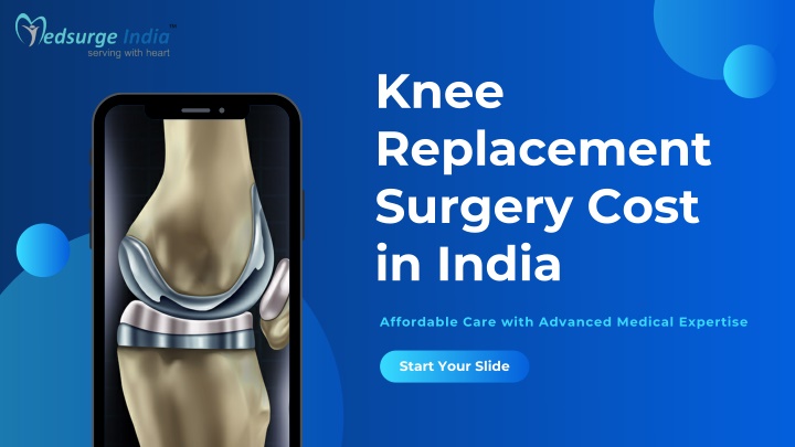 Knee Replacement Surgery Cost In Sakra Hospital PPT - Knee Replacement Surgery Cost in India PowerPoint Presentation