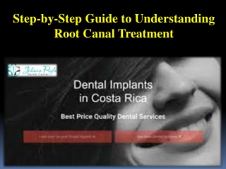 Step-by-Step Guide to Understanding Root Canal Treatment