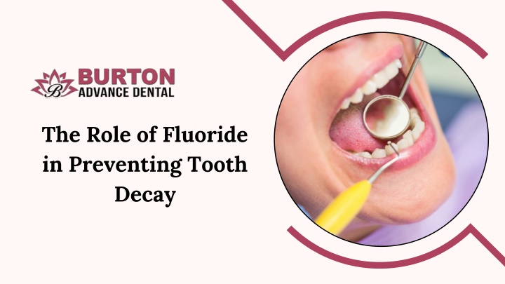 the role of fluoride in preventing tooth decay