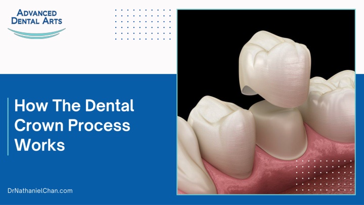 how the dental crown process works