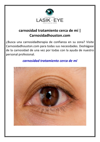 carnosidad tratamiento cerca de mí | Carnosidadhouston.com