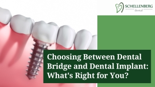 Deciding Between Dental Bridge and Implant: Your Best Choice