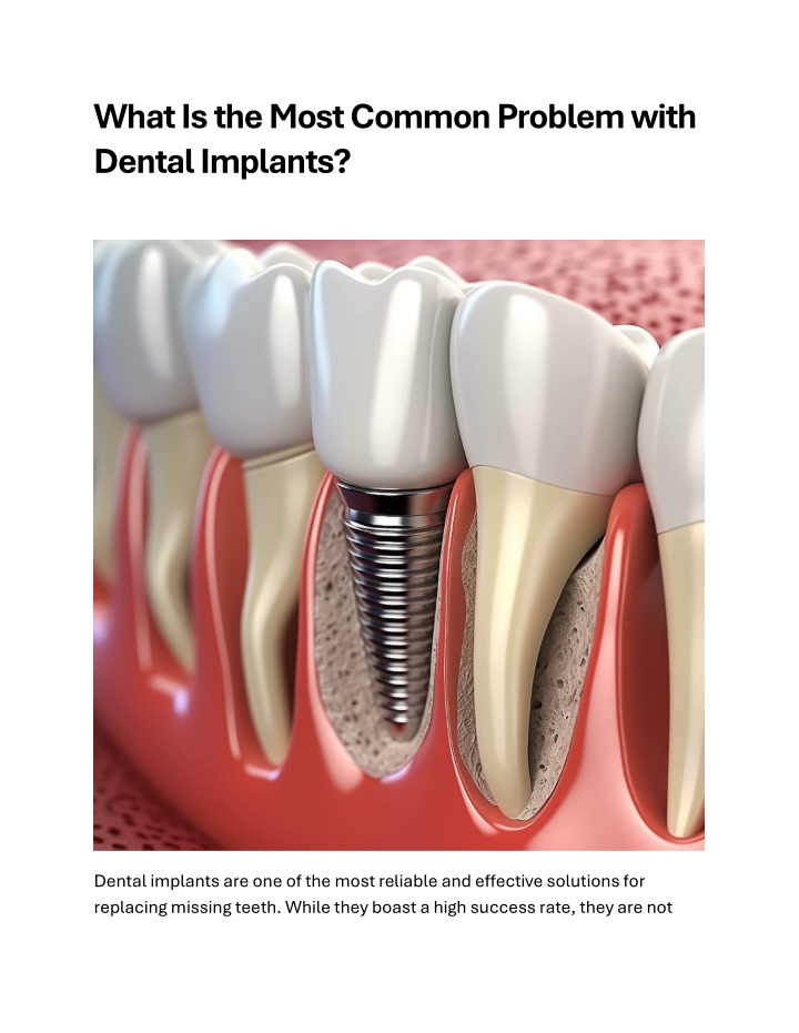 what is the most common problem with dental