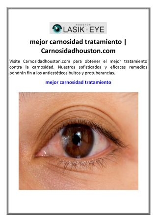 mejor carnosidad tratamiento | Carnosidadhouston.com