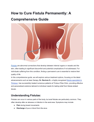 How to Cure Fistula Permanently_ A Comprehensive Guide