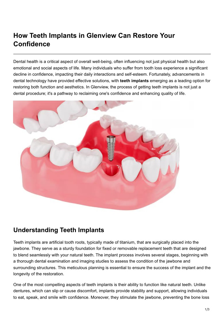 how teeth implants in glenview can restore your