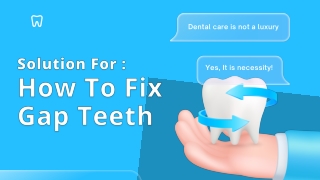 How To Fix Gap Teeth
