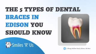 The 5 Types of Dental Braces in Edison You Should Know