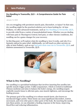 Dry Needling in Townsville, QLD – A Comprehensive Guide for Pain Relief