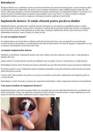 Implanturile dentare: O soluție eficientă pentru pierderea dinților